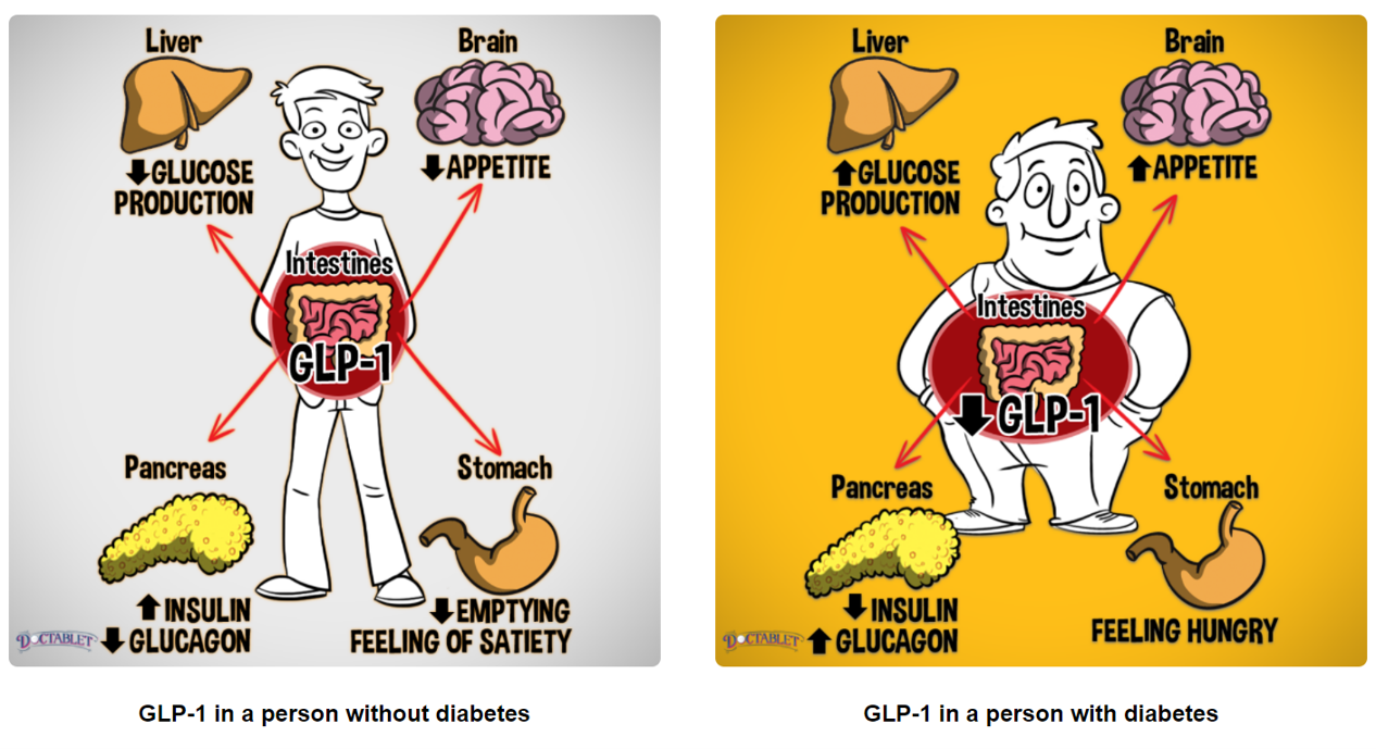 glp-1と糖尿病
